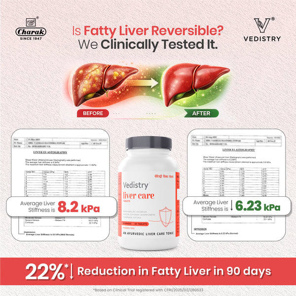 Vedistry Liver Care
